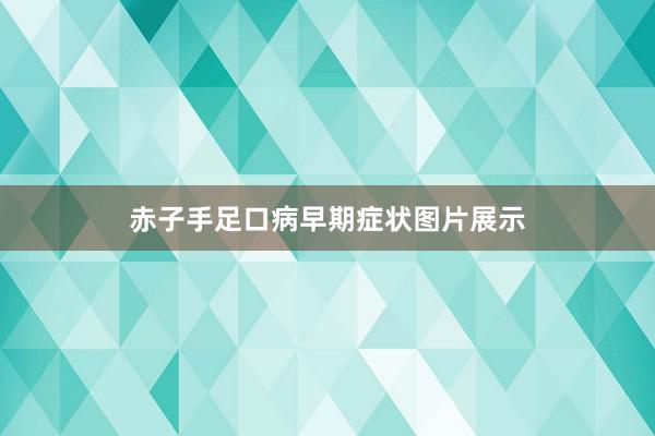 赤子手足口病早期症状图片展示